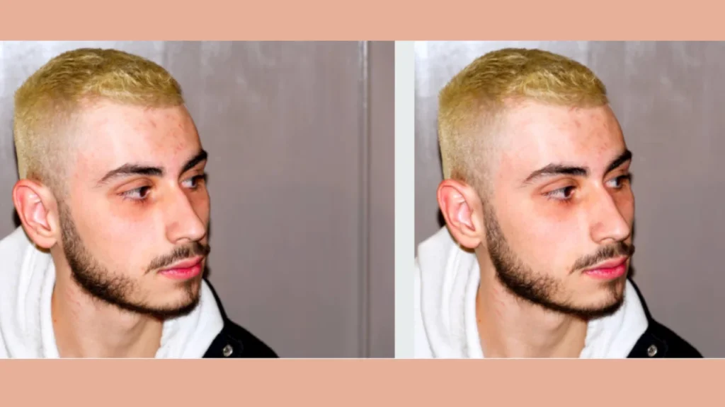 Why Choose Burst Fade Short Hair?
